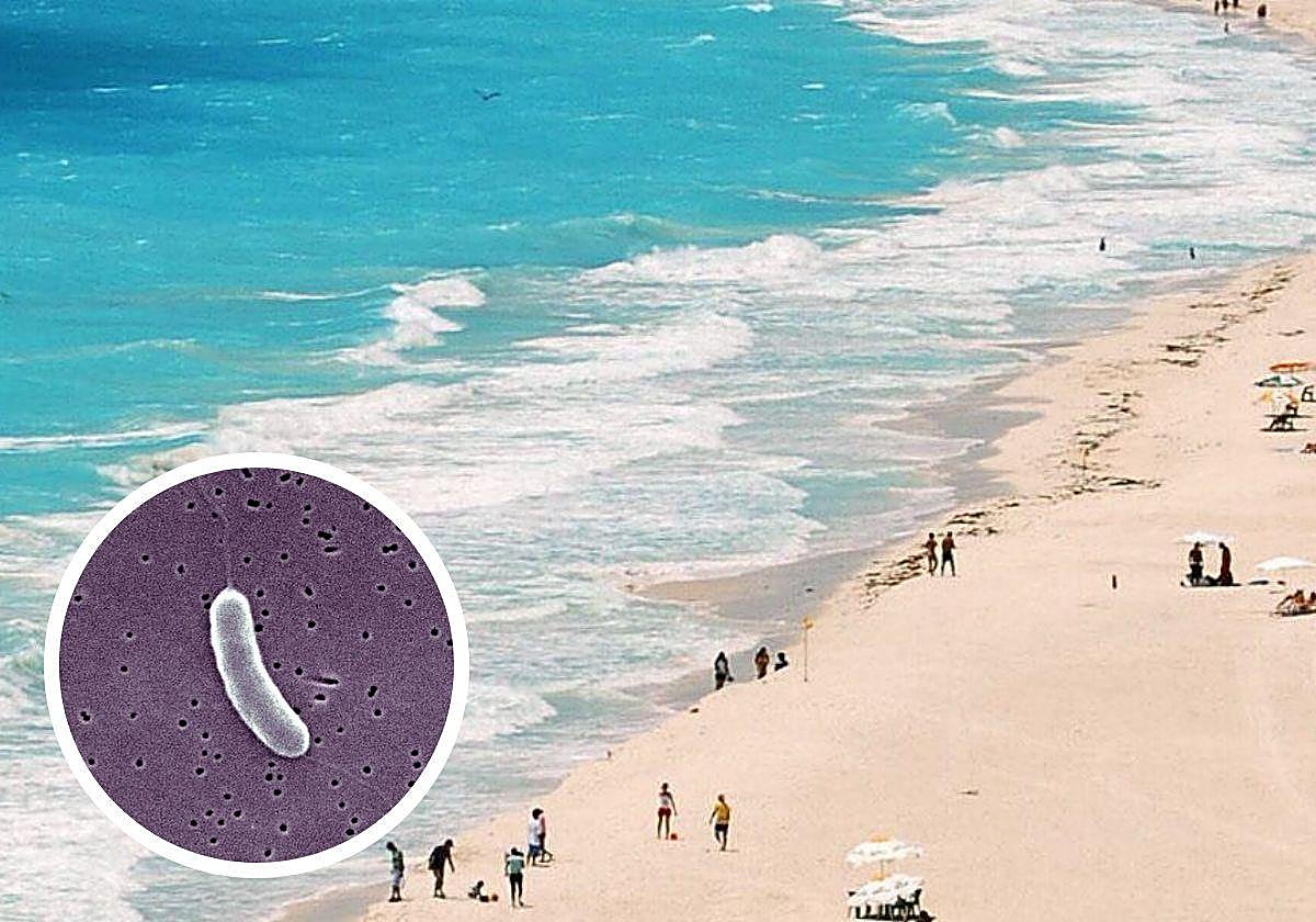 C mo Se Contagia La Bacteria come Carne Que Tiene En Alerta A Estados c-mo-se-contagia-la-bacteria-come-carne-que-tiene-en-alerta-a-estados